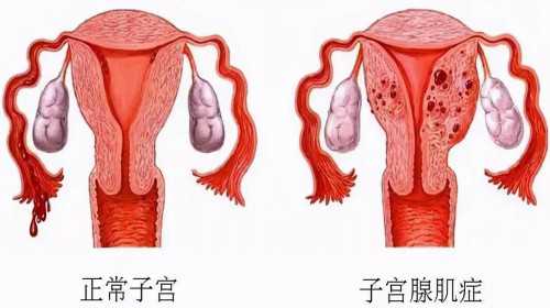 西安哪里供卵机构,上海国妇婴医院三代试管能选男女吗？附详细试管费用_西安